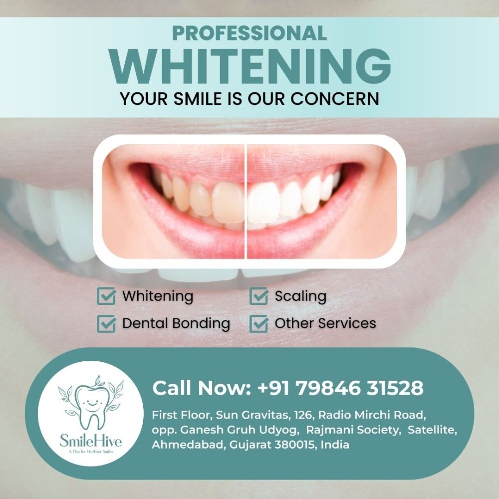 SmileHive Professional Whitening